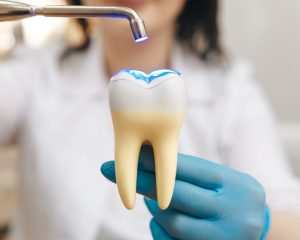 Dentist holding up giant model of tooth and showcasing a composite filling