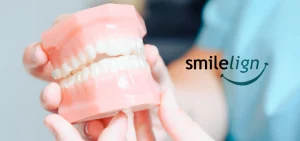 Model of teeth with Smilelign logo next to it